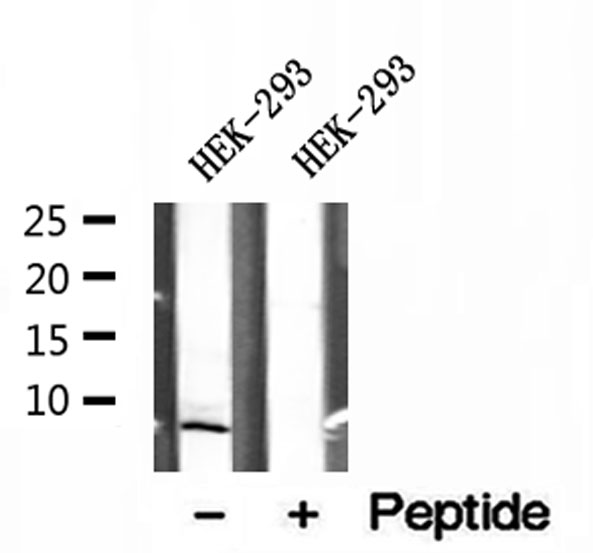 SEC61G Antibody - Western blot analysis of extracts of HEK293 cells using SEC61G antibody.