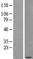 SEC61G Protein - Western validation with an anti-DDK antibody * L: Control HEK293 lysate R: Over-expression lysate