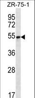 SEC62 / TP-1 Antibody - SEC62 Antibody western blot of ZR-75-1 cell line lysates (35 ug/lane). The SEC62 antibody detected the SEC62 protein (arrow).