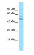 SEC62 / TP-1 Antibody - SEC62 / TP-1 antibody Western Blot of NCI-H226.  This image was taken for the unconjugated form of this product. Other forms have not been tested.