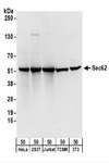 SEC62 / TP-1 Antibody - Detection of Human and Mouse Sec62 by Western Blot. Samples: Whole cell lysate (50 ug) from HeLa, 293T, Jurkat, mouse TCMK-1, and mouse NIH3T3 cells. Antibodies: Affinity purified rabbit anti-Sec62 antibody used for WB at 0.1 ug/ml. Detection: Chemiluminescence with an exposure time of 10 seconds.