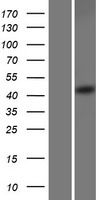SEC62 / TP-1 Protein - Western validation with an anti-DDK antibody * L: Control HEK293 lysate R: Over-expression lysate