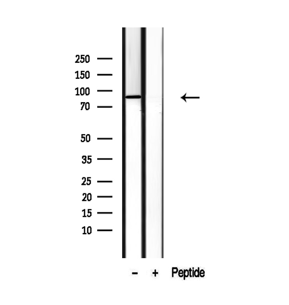 SEC63 Antibody - Western blot analysis of extracts of PC-3 cells using SEC63 antibody.