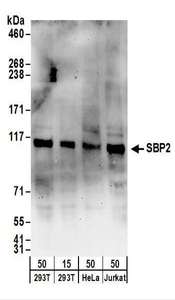 SECISBP2 / SBP2 Antibody - Detection of Human SBP2 by Western Blot. Samples: Whole cell lysate from 293T (15 and 50 ug), HeLa (50 ug), and Jurkat (50 ug) cells. Antibodies: Affinity purified rabbit anti-SBP2 antibody used for WB at 1 ug/ml. Detection: Chemiluminescence with an exposure time of 3 minutes.