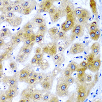SECISBP2 / SBP2 Antibody - Immunohistochemistry of paraffin-embedded human liver injury tissue.