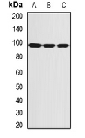 SECISBP2 / SBP2 Antibody - Western blot analysis of SBP-2 expression in MCF7 (A); HeLa (B); mouse thymus (C) whole cell lysates.
