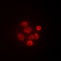 SECISBP2 / SBP2 Antibody - Immunofluorescent analysis of SBP-2 staining in HeLa cells. Formalin-fixed cells were permeabilized with 0.1% Triton X-100 in TBS for 5-10 minutes and blocked with 3% BSA-PBS for 30 minutes at room temperature. Cells were probed with the primary antibody in 3% BSA-PBS and incubated overnight at 4 deg C in a humidified chamber. Cells were washed with PBST and incubated with a DyLight 594-conjugated secondary antibody (red) in PBS at room temperature in the dark.