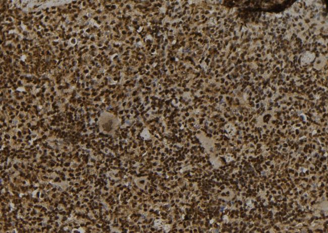SECISBP2 / SBP2 Antibody - 1:100 staining mouse spleen tissue by IHC-P. The sample was formaldehyde fixed and a heat mediated antigen retrieval step in citrate buffer was performed. The sample was then blocked and incubated with the antibody for 1.5 hours at 22°C. An HRP conjugated goat anti-rabbit antibody was used as the secondary.