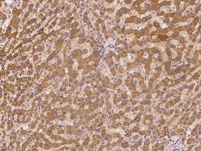 SECISBP2L Antibody - Immunochemical staining of human SECISBP2L in human liver with rabbit polyclonal antibody at 1:500 dilution, formalin-fixed paraffin embedded sections.