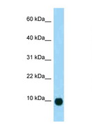 Secretin Antibody - SCT / Secretin antibody Western blot of Mouse Pancreas lysate. Antibody concentration 1 ug/ml.  This image was taken for the unconjugated form of this product. Other forms have not been tested.
