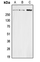 Secretin Antibody - Western blot analysis of Secretin expression in HEK293T (A); Raw264.7 (B); H9C2 (C) whole cell lysates.