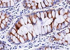 Secretory Component Antibody - Secretory Component antibody SC05 immunohistochemistry This image was taken for the unmodified form of this product. Other forms have not been tested.