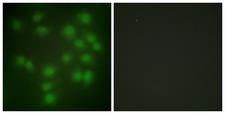 Securin / PTTG1 Antibody - Immunofluorescence analysis of HUVEC cells, using PTTG1 Antibody. The picture on the right is blocked with the synthesized peptide.