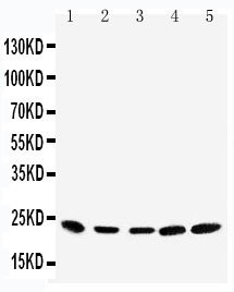Securin / PTTG1 Antibody - WB of Securin / PTTG1 antibody. Lane 1: Rat Testis Tissue Lysate. Lane 2: HELA Cell Lysate. Lane 3: MCF-7 Cell Lysate. Lane 4: SKOV-3 Cell Lysate. Lane 5: A575 Cell Lysate.