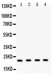 Securin / PTTG1 Antibody - Anti-Securin antibody, Western blotting All lanes: Anti PTTG1 at 0.5ug/ml Lane 1: HELA Whole Cell Lysate at 40ugLane 2: MCF-7 Whole Cell Lysate at 40ugLane 3: SKOV Whole Cell Lysate at 40ugLane 4: A375 Whole Cell Lysate at 40ugPredicted bind size: 22KD Observed bind size: 22KD