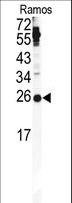 Securin / PTTG1 Antibody - Western blot of PTTG1 antibody in Ramos cell line lysates (35 ug/lane). PTTG1 (arrow) was detected using the purified antibody.