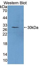 Securin / PTTG1 Antibody - Western blot of Securin / PTTG1 antibody.