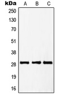 Securin / PTTG1 Antibody - Western blot analysis of PTTG1/2/3 expression in HepG2 (A); Jurkat (B); NIH3T3 (C) whole cell lysates.