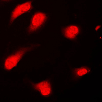 Securin / PTTG1 Antibody - Immunofluorescent analysis of PTTG1/2/3 staining in Jurkat cells. Formalin-fixed cells were permeabilized with 0.1% Triton X-100 in TBS for 5-10 minutes and blocked with 3% BSA-PBS for 30 minutes at room temperature. Cells were probed with the primary antibody in 3% BSA-PBS and incubated overnight at 4 C in a humidified chamber. Cells were washed with PBST and incubated with a DyLight 594-conjugated secondary antibody (red) in PBS at room temperature in the dark. DAPI was used to stain the cell nuclei (blue).