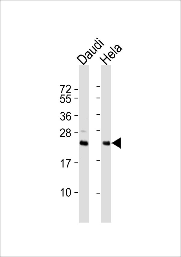 Securin / PTTG1 Antibody - All lanes : Anti-PTTG1/2/3 Antibody at 1:1000 dilution Lane 1: Daudi whole cell lysates Lane 2: HeLa whole cell lysates Lysates/proteins at 20 ug per lane. Secondary Goat Anti-Rabbit IgG, (H+L),Peroxidase conjugated at 1/10000 dilution Predicted band size : 22 kDa Blocking/Dilution buffer: 5% NFDM/TBST.
