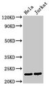 Securin / PTTG1 Antibody - Positive Western Blot detected in Hela whole cell lysate, Jurkat whole cell lysate. All lanes: PTTG1 antibody at 3 µg/ml Secondary Goat polyclonal to rabbit IgG at 1/50000 dilution. Predicted band size: 23 KDa. Observed band size: 23 KDa