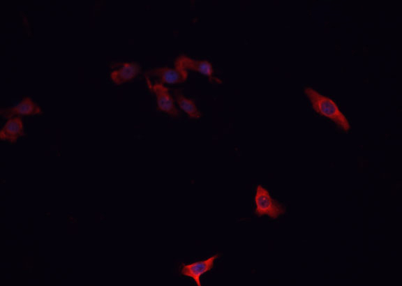 Securin / PTTG1 Antibody - Staining HepG2 cells by IF/ICC. The samples were fixed with PFA and permeabilized in 0.1% Triton X-100, then blocked in 10% serum for 45 min at 25°C. The primary antibody was diluted at 1:200 and incubated with the sample for 1 hour at 37°C. An Alexa Fluor 594 conjugated goat anti-rabbit IgG (H+L) Ab, diluted at 1/600, was used as the secondary antibody.