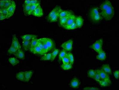 SEL1L Antibody - Immunofluorescence staining of HepG2 cells at a dilution of 1:33, counter-stained with DAPI. The cells were fixed in 4% formaldehyde, permeabilized using 0.2% Triton X-100 and blocked in 10% normal Goat Serum. The cells were then incubated with the antibody overnight at 4 °C.The secondary antibody was Alexa Fluor 488-congugated AffiniPure Goat Anti-Rabbit IgG (H+L) .