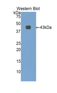SELE / CD62E / E-selectin Antibody - Western blot of recombinant SELE / CD62E / E-selectin.  This image was taken for the unconjugated form of this product. Other forms have not been tested.