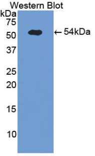 SELE / CD62E / E-selectin Antibody - Western Blot; Sample: Recombinant protein.