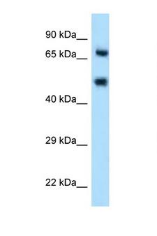 SELE / CD62E / E-selectin Antibody - SELE / CD62E antibody Western blot of HT1080 Cell lysate. Antibody concentration 1 ug/ml. This image was taken for the unconjugated form of this product. Other forms have not been tested.