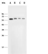 SELE / CD62E / E-selectin Antibody - Anti-SELE rabbit monoclonal antibody at 1:500 dilution. Lane A: Jurkat Whole Cell Lysate. Lane B: Mouse liver tissue lysate. Lane C: Mouse spleen tissue lysate. Lane D: Mouse brain tissue lysate. Lysates/proteins at 30 ug per lane. Secondary: Goat Anti-Rabbit IgG (H+L)/HRP at 1/10000 dilution. Developed using the ECL technique. Performed under reducing conditions. Predicted band size: 67 kDa. Observed band size: 67 kDa.