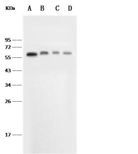 SELE / CD62E / E-selectin Antibody - Anti-SELE rabbit monoclonal antibody at 1:500 dilution. Lane A: Jurkat Whole Cell Lysate. Lane B: Mouse liver tissue lysate. Lane C: Mouse spleen tissue lysate. Lane D: Mouse brain tissue lysate. Lysates/proteins at 30 ug per lane. Secondary: Goat Anti-Rabbit IgG (H+L)/HRP at 1/10000 dilution. Developed using the ECL technique. Performed under reducing conditions. Predicted band size: 67 kDa. Observed band size: 67 kDa.