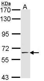 SELE / CD62E / E-selectin Antibody - Sample (30 ug of whole cell lysate). A: H1299. 7.5% SDS PAGE. SELE antibody diluted at 1:1000. 