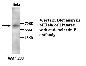 SELE / CD62E / E-selectin Antibody