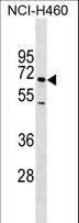 SELE / CD62E / E-selectin Antibody - SELE Antibody western blot of NCI-H460 cell line lysates (35 ug/lane). The SELE antibody detected the SELE protein (arrow).