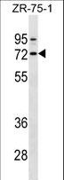 SELE / CD62E / E-selectin Antibody - SELE Antibody (Ascites)western blot of ZR-75-1 cell line lysates (35 ug/lane). The SELE antibody detected the SELE protein (arrow).