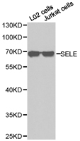 SELE / CD62E / E-selectin Antibody - Western blot of extracts of various cell lines, using SELE antibody.