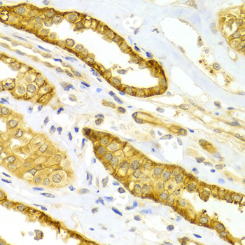 SELE / CD62E / E-selectin Antibody - Immunohistochemistry of paraffin-embedded Human kidney tissue.
