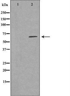 SELE / CD62E / E-selectin Antibody - Western blot analysis of Jurkat whole cells lysates using SELE antibody. The lane on the left is treated with the antigen-specific peptide.
