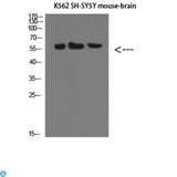 SELE / CD62E / E-selectin Antibody - Immunohistochemical analysis of paraffin-embedded human-colon, antibody was diluted at 1:200.
