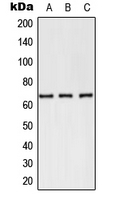 SELE / CD62E / E-selectin Antibody - Western blot analysis of CD62E expression in PC12 (A); NIH3T3 (B); Jurkat (C) whole cell lysates.