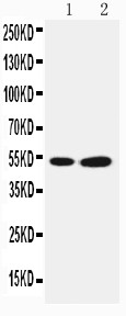 Selenium Binding Protein 1 Antibody - WB of SELENBP1 / SP56 antibody. Lane 1: COLO320 Cell Lysate. Lane 2: PANC Cell Lysate.