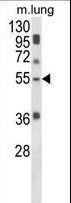 Selenium Binding Protein 1 Antibody - Western blot of SELENBP1 Antibody in mouse lung tissue lysates (35 ug/lane). SELENBP1 (arrow) was detected using the purified antibody.