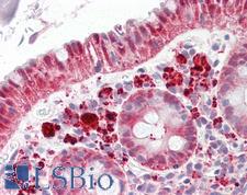 Selenium Binding Protein 1 Antibody - Anti-SELENBP1 / SP56 antibody IHC of human colon. Immunohistochemistry of formalin-fixed, paraffin-embedded tissue after heat-induced antigen retrieval. Antibody dilution 2.5-5 ug/ml. This image was taken for the unconjugated form of this product. Other forms have not been tested.