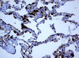 Selenium Binding Protein 1 Antibody - IHC of paraffin-embedded Human lung tissue using anti-SELENBP1 mouse monoclonal antibody.