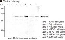 Selenium Binding Protein 1 Antibody