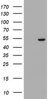 Selenium Binding Protein 1 Antibody - HEK293T cells were transfected with the pCMV6-ENTRY control (Left lane) or pCMV6-ENTRY SELENBP1 (Right lane) cDNA for 48 hrs and lysed. Equivalent amounts of cell lysates (5 ug per lane) were separated by SDS-PAGE and immunoblotted with anti-SELENBP1.