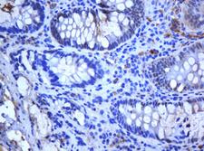 Selenium Binding Protein 1 Antibody - IHC of paraffin-embedded Human colon tissue using anti-SELENBP1 mouse monoclonal antibody.