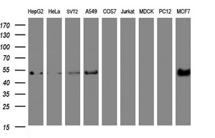 Selenium Binding Protein 1 Antibody - Western blot of extracts (35 ug) from 9 different cell lines by using anti-SELENBP1 monoclonal antibody (HepG2: human; HeLa: human; SVT2: mouse; A549: human; COS7: monkey; Jurkat: human; MDCK: canine; PC12: rat; MCF7: human).