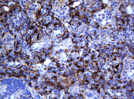 Selenium Binding Protein 1 Antibody - IHC of paraffin-embedded Human lymph node tissue using anti-SELENBP1 mouse monoclonal antibody.